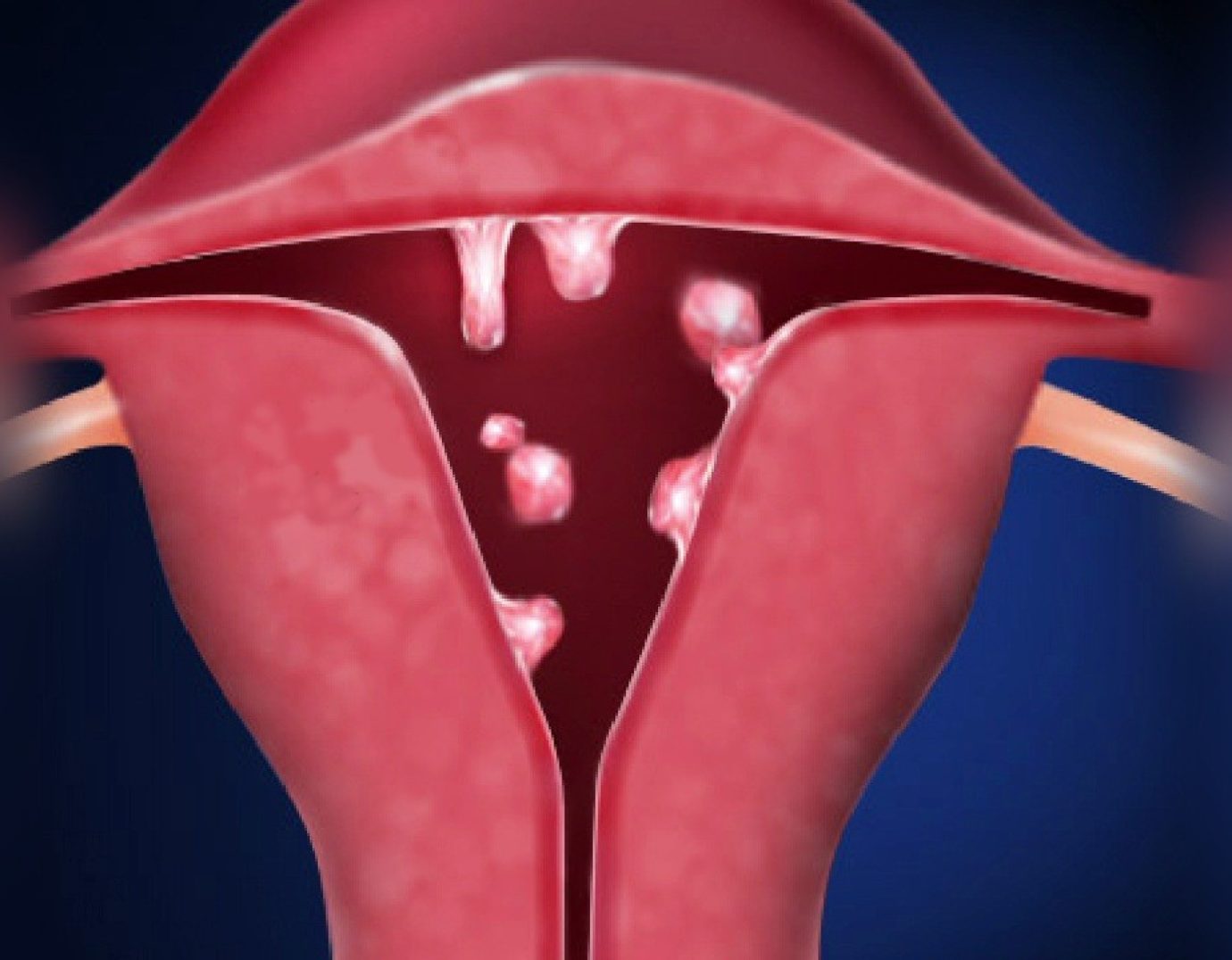 Biopsy of the labiavulva New Hospital