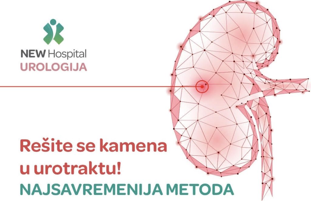 NEW Hospital jedina ustanova koja primenjuje Trilogy aparat za razbijanje kamena u urotraktu