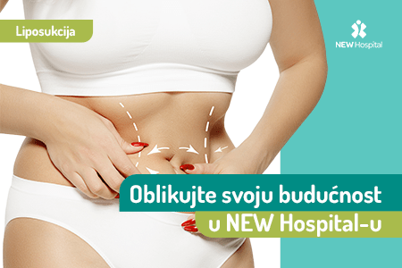 Vaš put do savršenog Tela: Eksperti za liposukciju u Novom Sadu – OB NEW Hospital