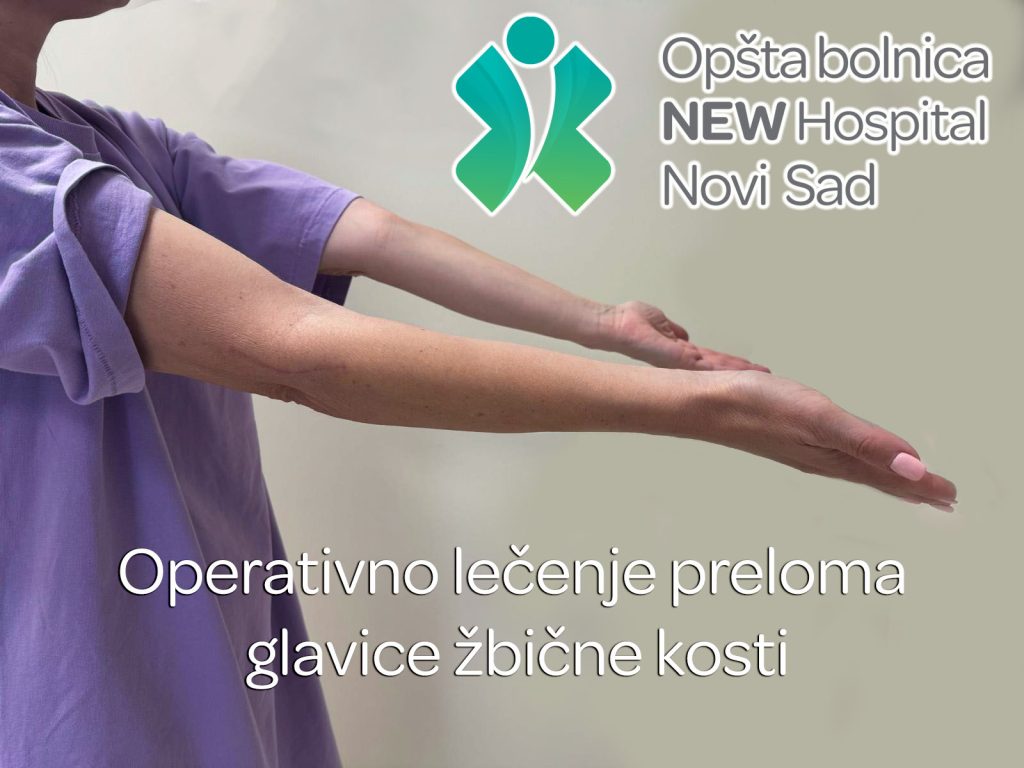 Operativno lečenje preloma glavice žbične kosti